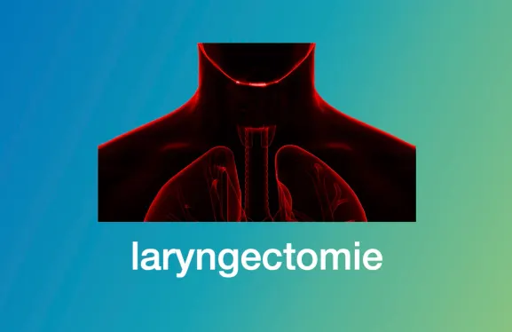 laryngectomie in behandeling